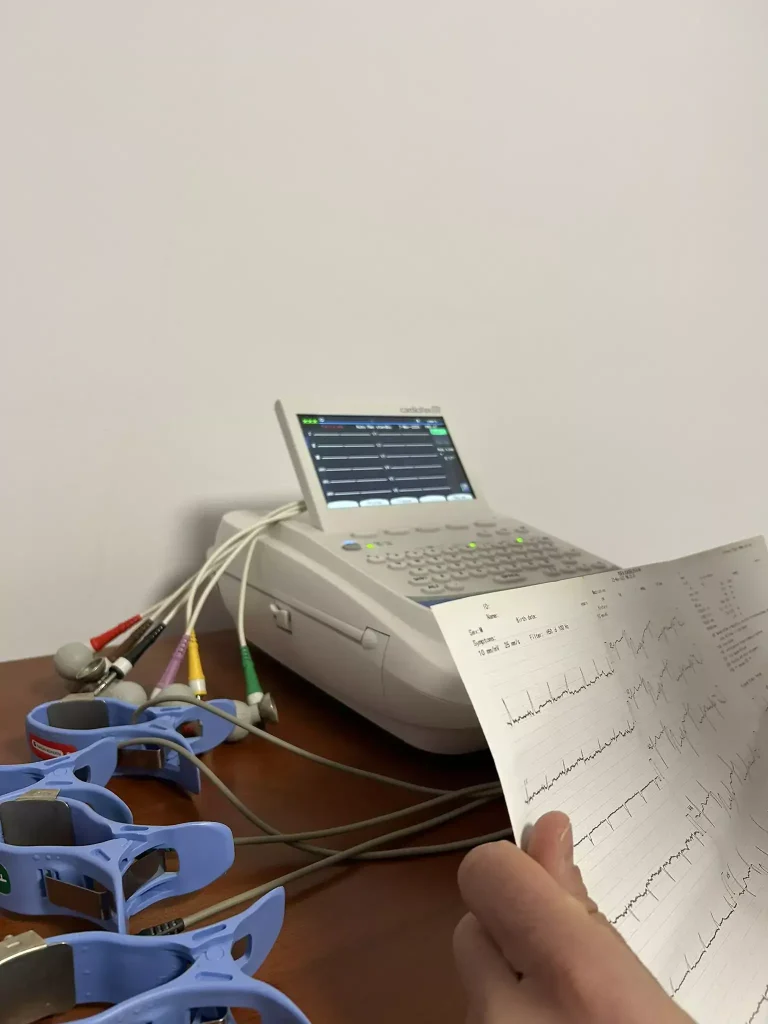 EKG cu interpretare realizat la cabinet cardiologic din Brașov