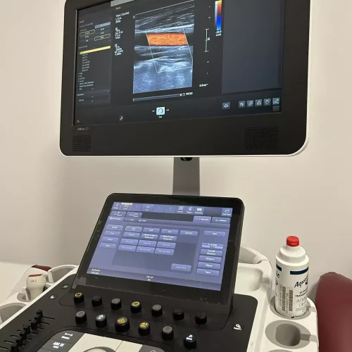 Aparat ecografie cardiacă Brasov - diagnostic avansat pentru sănătatea inimii