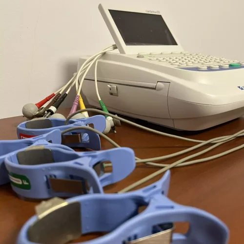 Pret EKG Brasov - aparat pentru electrocardiograma cu interpretare pentru diagnostic cardiac
