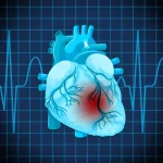 Infarctul miocardic: simptome și metode de prevenție