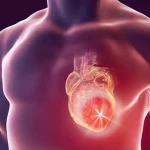 Inimă afectată de insuficiența cardiacă, vedere anatomică