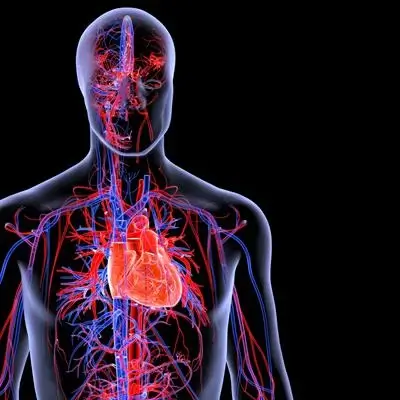 Cum afectează diabetul zaharat tip 2 inima și vasele de sânge prin inflamație și ateroscleroză