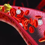 Anticoagulant in fibrilație atrială pentru prevenirea accidentului vascular cerebral