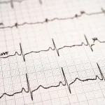 Pacient analizând electrocardiograma cu medic cardiolog, EKG normal și sănătatea inimii