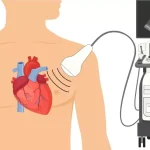 Ecografia inimii normală nu exclude complet bolile cardiace ascunse
