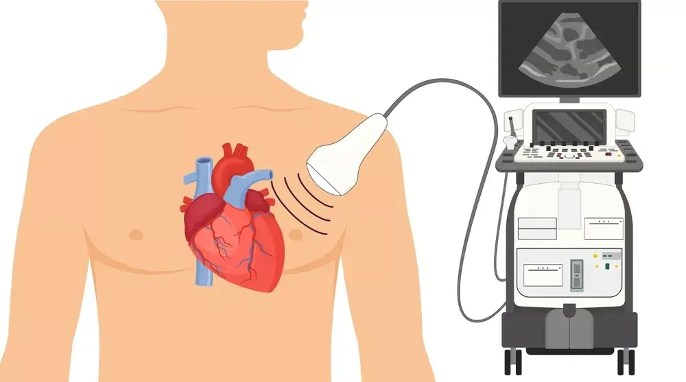 Ecografia inimii normală nu exclude complet bolile cardiace ascunse