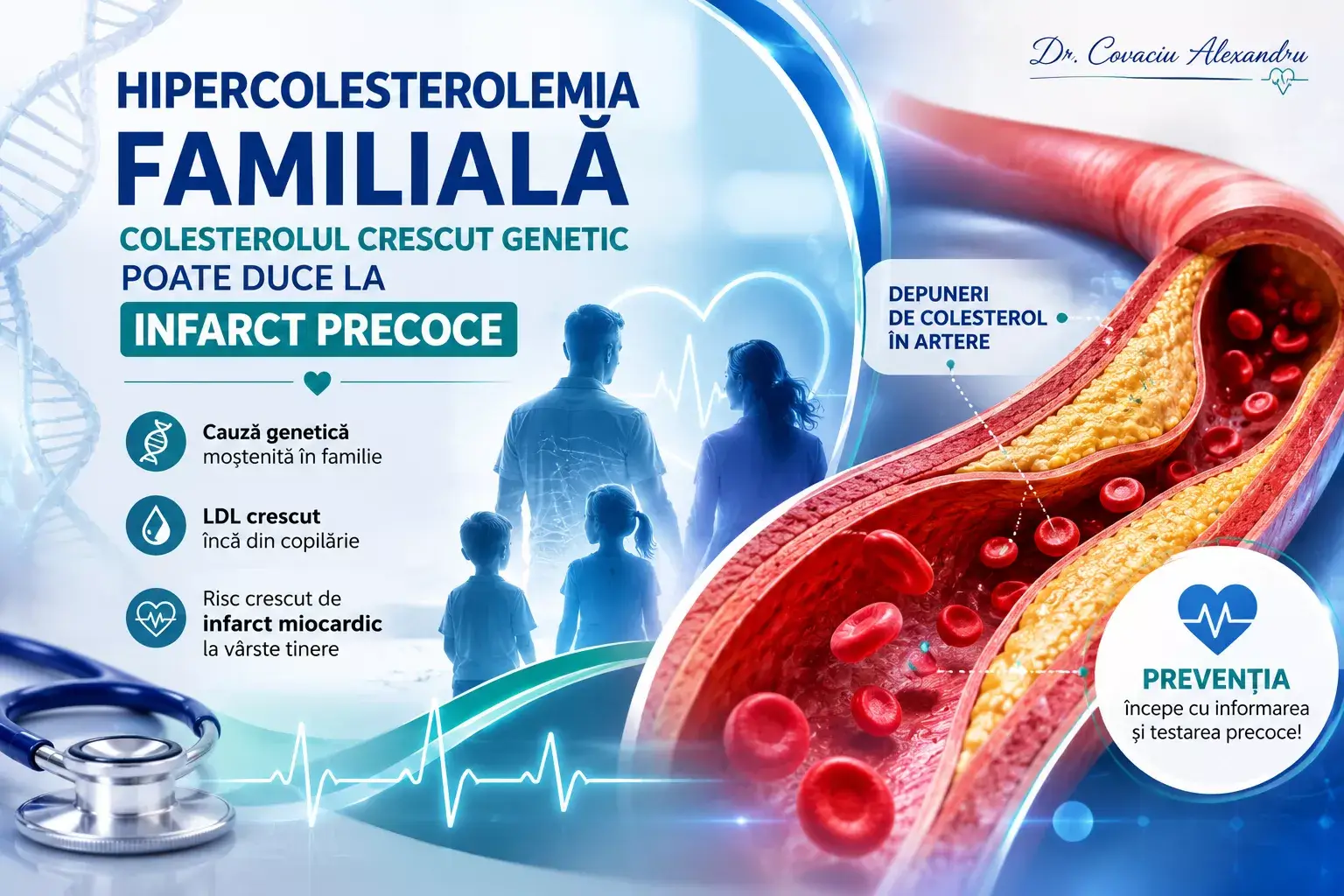 Hipercolesterolemia familială crește riscul de infarct miocardic precoce prin acumularea colesterolului LDL în artere.