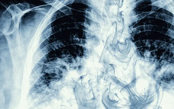 Pacient cu palpitații asociate utilizării vape-ului consultat în cabinet de cardiologie