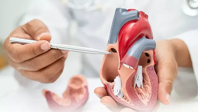 Suflu sistolic la inimă ilustrat prin flux sanguin turbulent la nivelul valvelor cardiace.