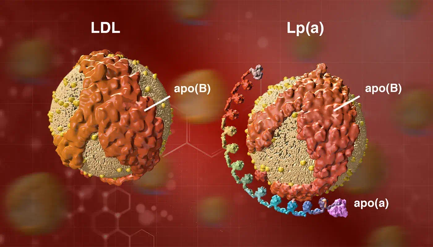 Comparație între LDL și lipoproteina(a) pentru evaluarea riscului cardiovascular