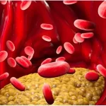 Trigliceridele crescute - cauze, riscuri cardiovasculare si opțiuni de tratament